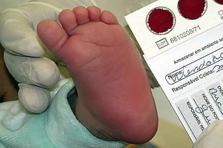 27 de outubro: Dia nacional de luta pelos direitos das pessoas com doenças falciformes